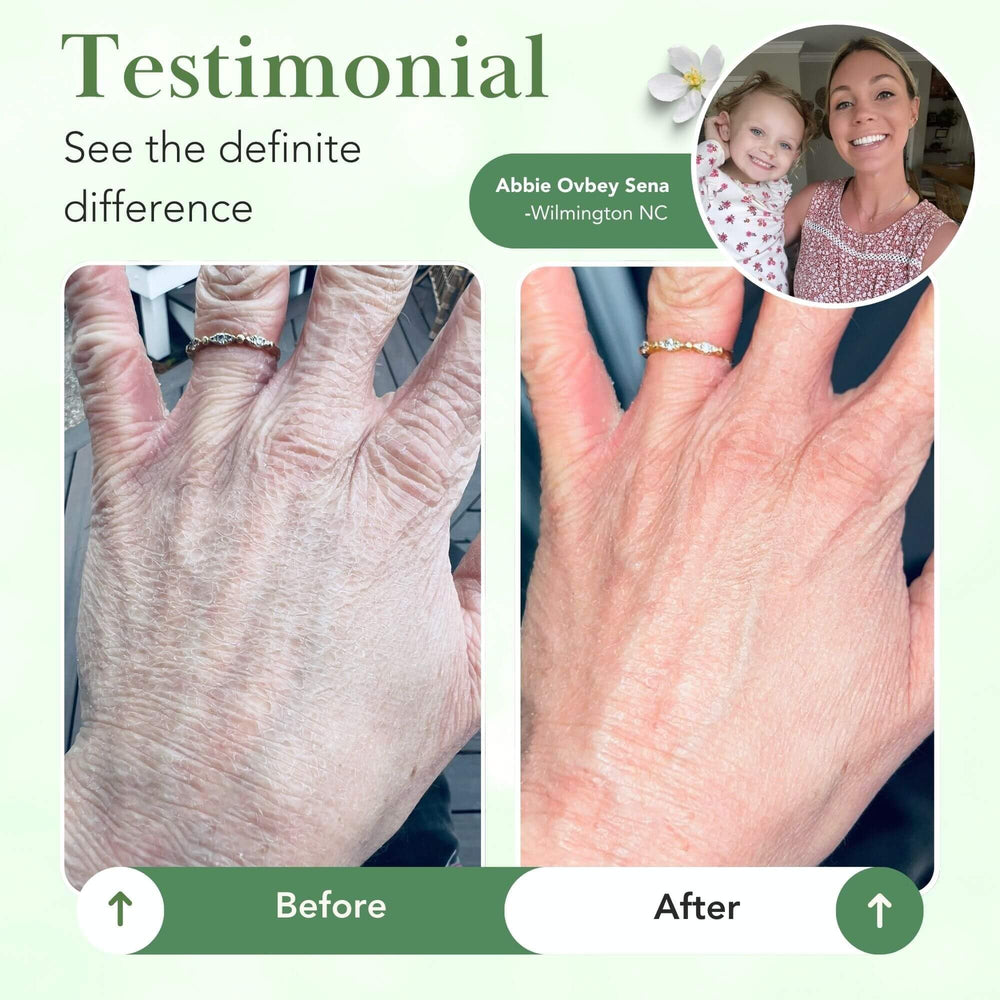 Theraplex Crème Barrière – formule sans parfum adaptée aux peaux sensibles.