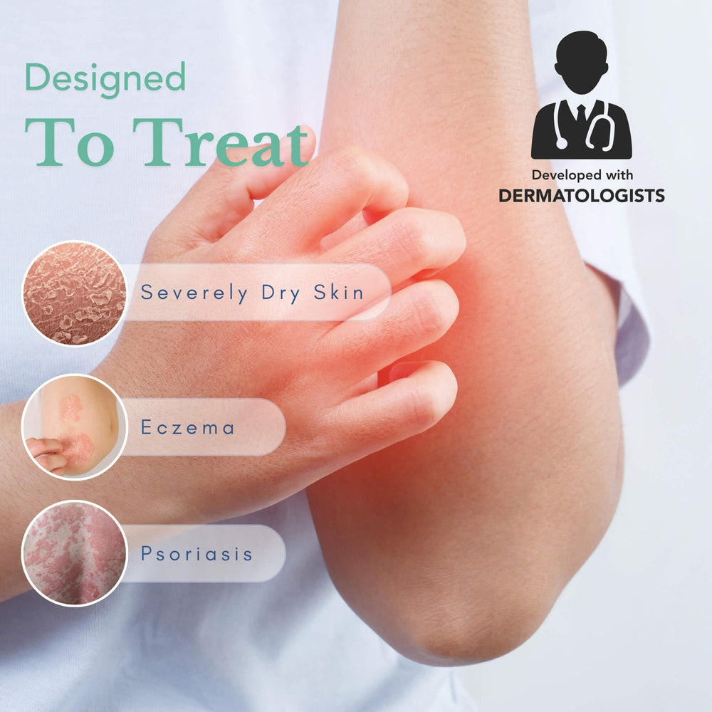 Theraplex Crème émolliente – application sur les mains sèches, soulage et protège.