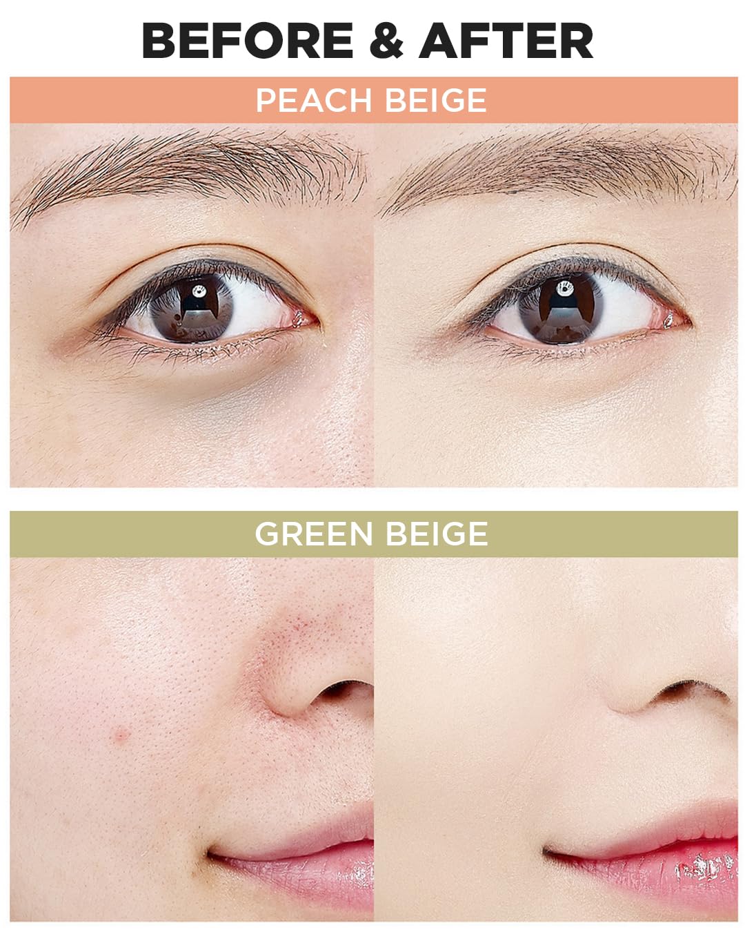THESAEM Système de couverture en pot pour une correction ciblée.