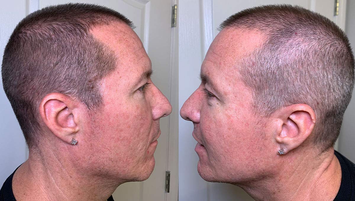 Thicken It: utilisation quotidienne pour coiffage rapide et naturel.