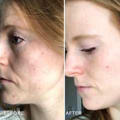Three Ships Refresh Papaya – Acide salicylique naturel purifiant les pores