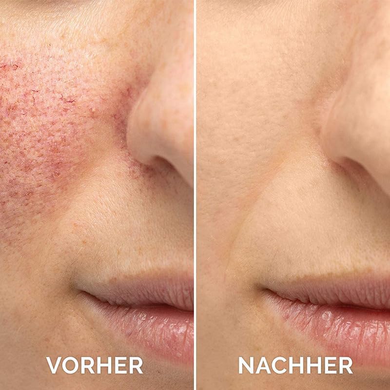THUIOP sérum vitamine C — teint plus lumineux et éclat naturel.