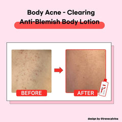 TIAM Lotion Corps Apaisement après rasage – calme les irritations et rougeurs éventuelles.