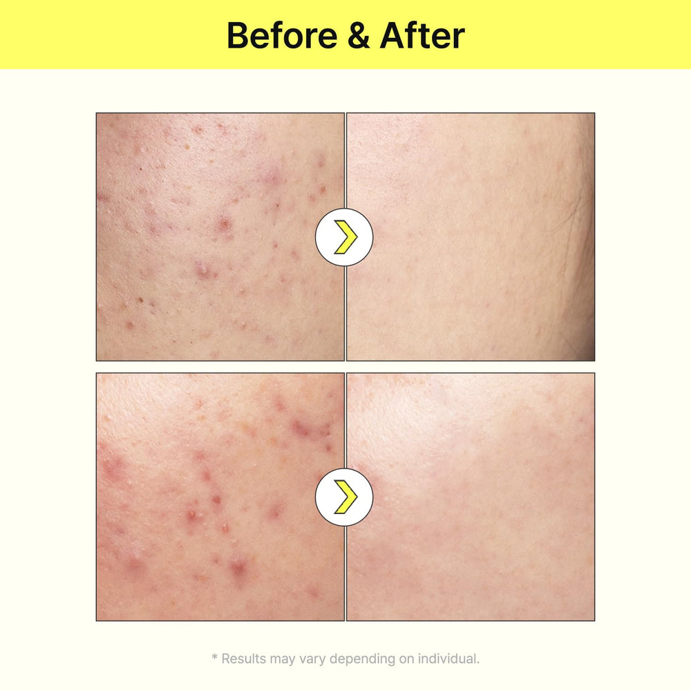 TIAM Vita B3 Source Serum — peau plus lumineuse après chaque application personnalisée.