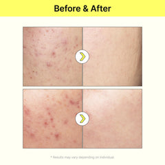 TIAM Vita B3 Source Serum — peau plus lumineuse après chaque application personnalisée.