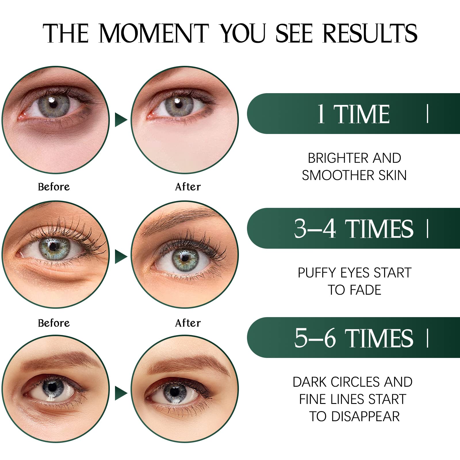 Tiepetly outil-cuillere pour retirer les patches facilement.
