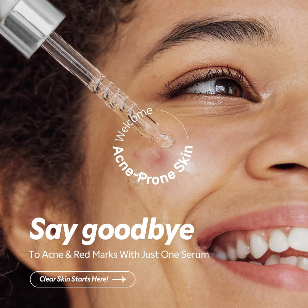 Sérum TIRTIR Azélaïque 12% — pipette facilitant le dosage et l’hydratation légère.