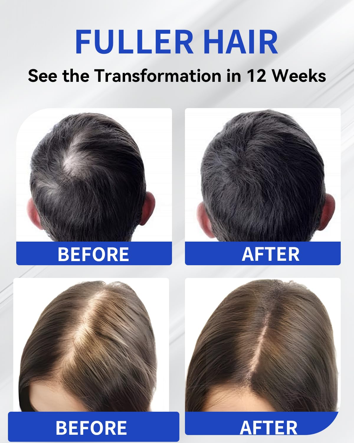 TJE Hair Growth Serum – extrait de romarin et caféine pour nourrir le cuir chevelu.