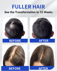 TJE Hair Growth Serum – extrait de romarin et caféine pour nourrir le cuir chevelu.
