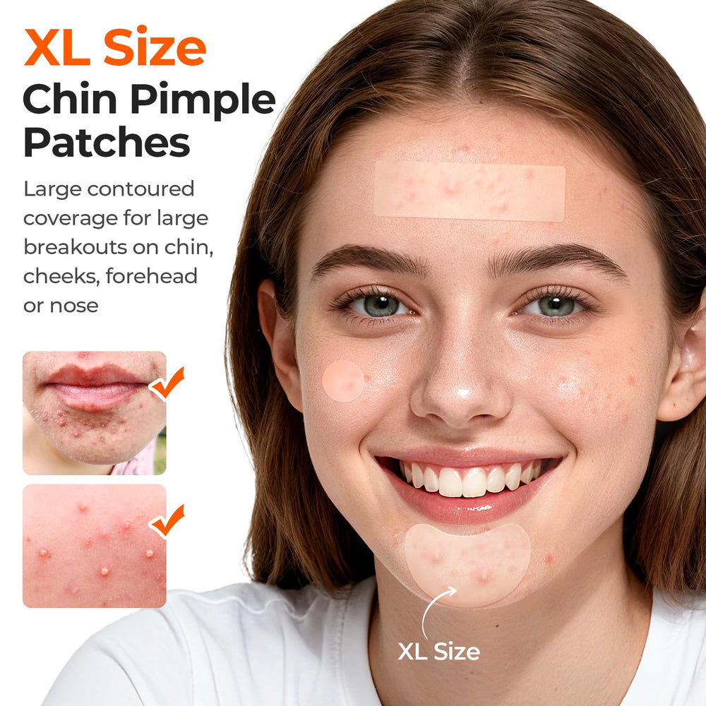 Bandes hydrocolloide TKTK pour nettoyage des pores 60x20mm.