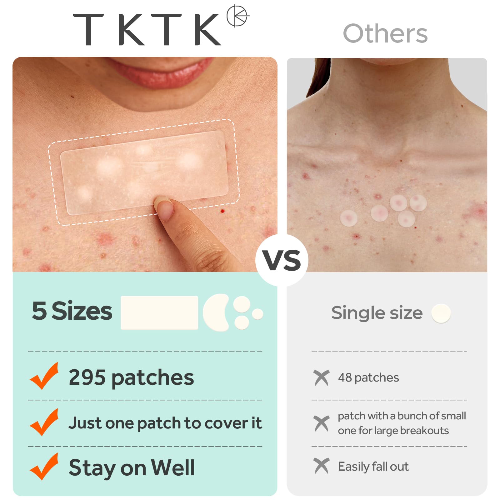 Pansements TKTK XL pour le nez, zones sensibles protégées.