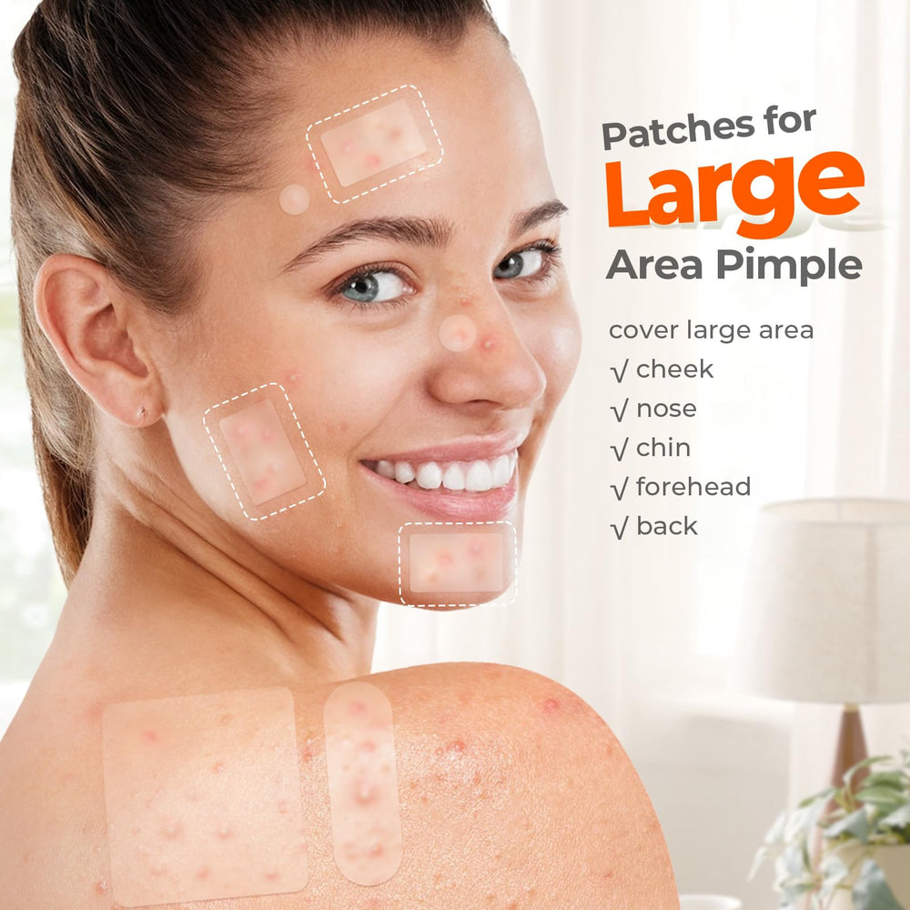 Patch TKTK grand menton, solution discrète pour les boutons.
