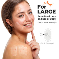 Patches TKTK 45x45mm pour le visage, couverture efficace des zones complexes.