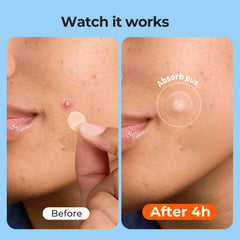 Bandes TKTK 91x48 mm pour pores du nez et zones T sensibles.