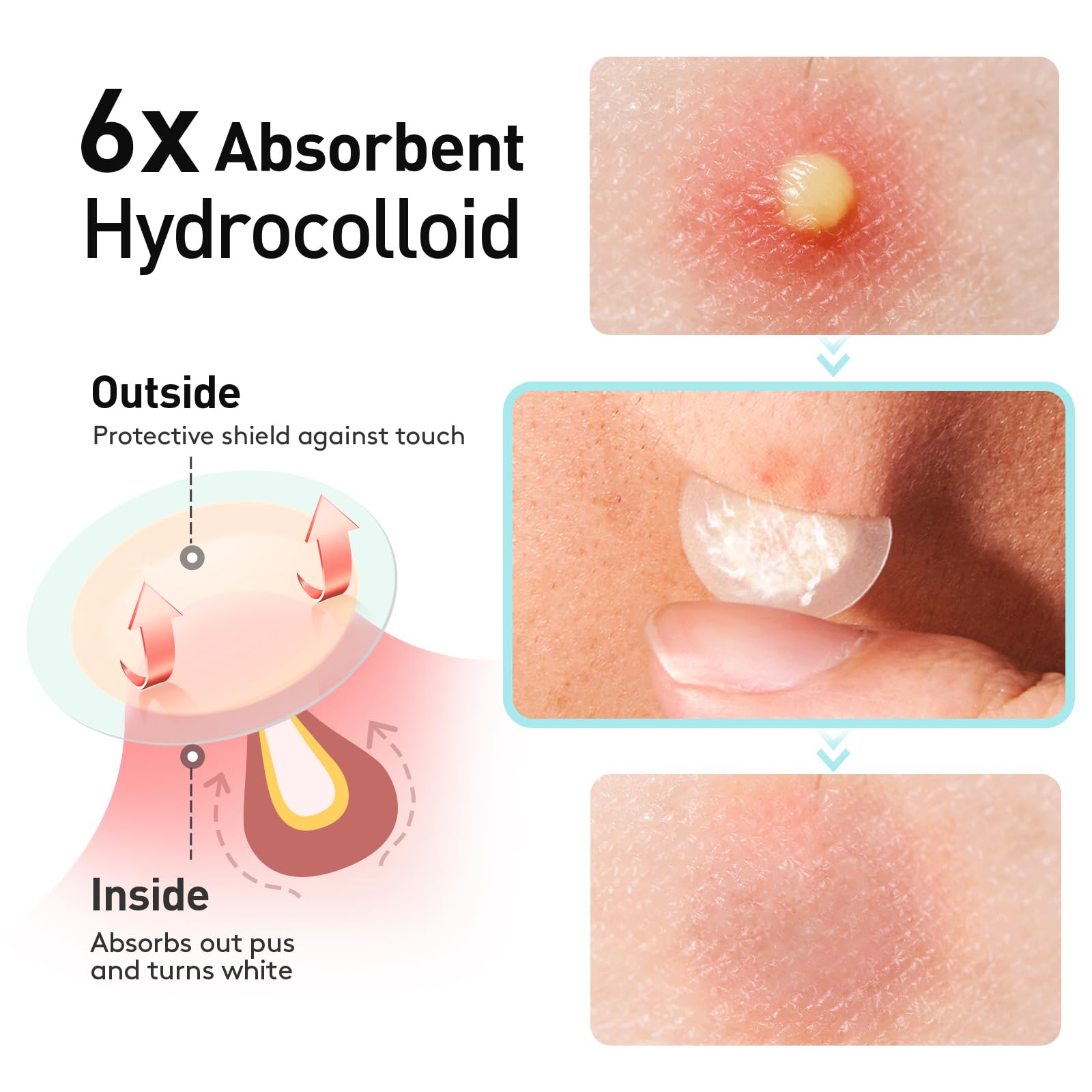 Application facile TKTK, décollement individuel propre et hygiénique.