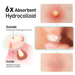 Application facile TKTK, décollement individuel propre et hygiénique.