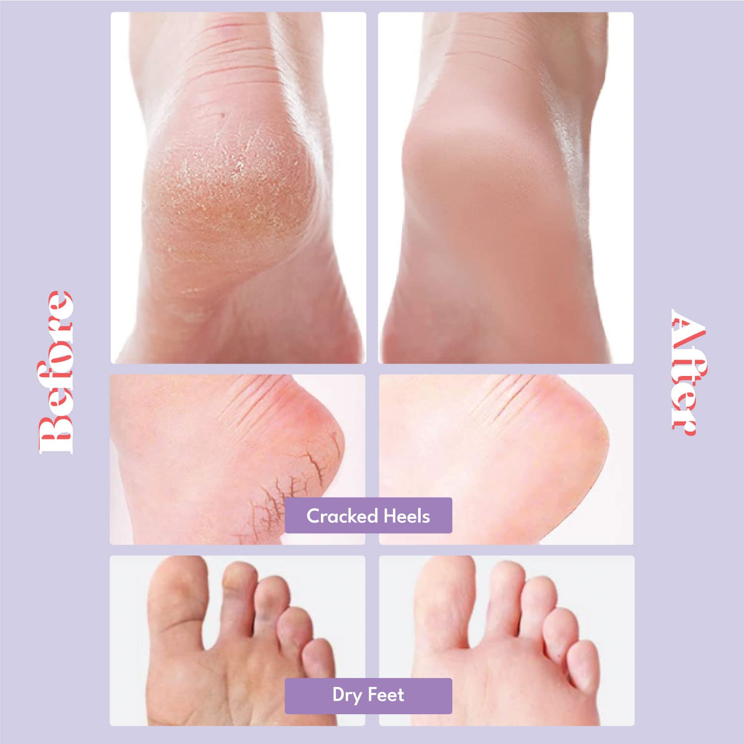 Toi:L – application du masque-pieds pendant 20 minutes sans rinçage.