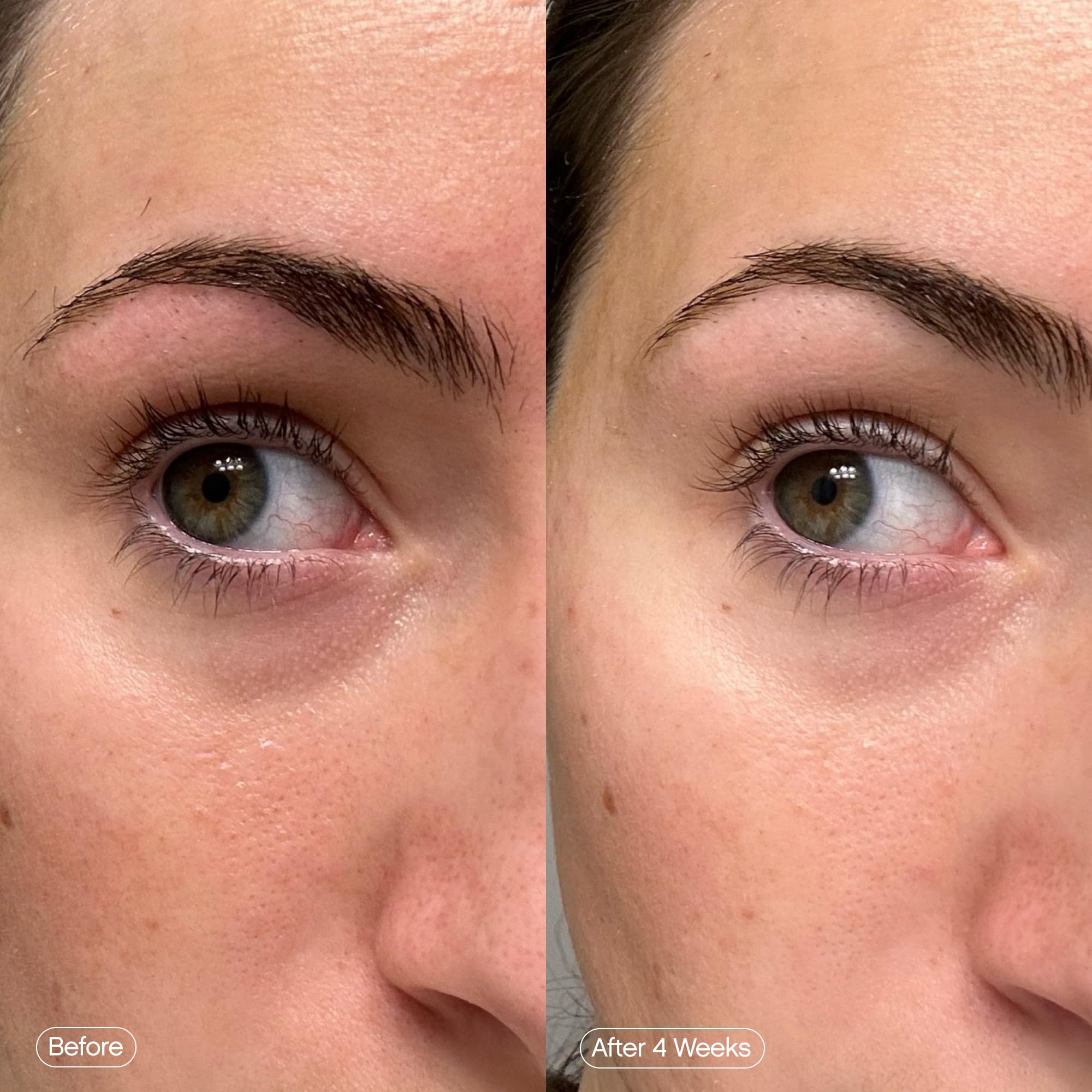 Topicals Faded ingrédients Niacinamide, Caféine et Acide Kojique pour éclairer et lisser.