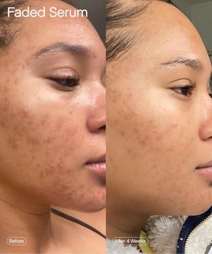 Topicals Faded: ingredients-kojic-acide visibles pour l'éclat du teint