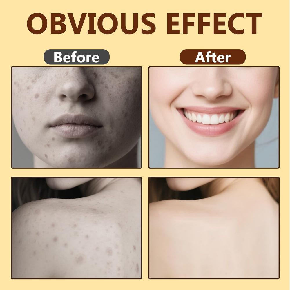 Topicy Bee Venom Cream used on knees, necks, and wrists in daily routine