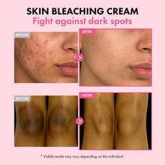 Texture légère de la crème TOSOWOONG Dark Spot 35, absorption rapide.