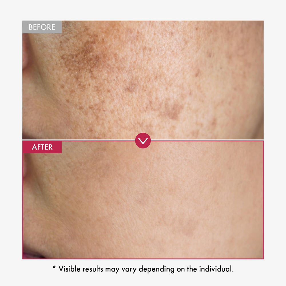 Ingrédients clés TOSOWOONG: niacinamide, acide tranexamique et arbutine pour un éclat ciblé.