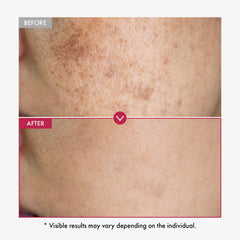 Ingrédients clés TOSOWOONG: niacinamide, acide tranexamique et arbutine pour un éclat ciblé.
