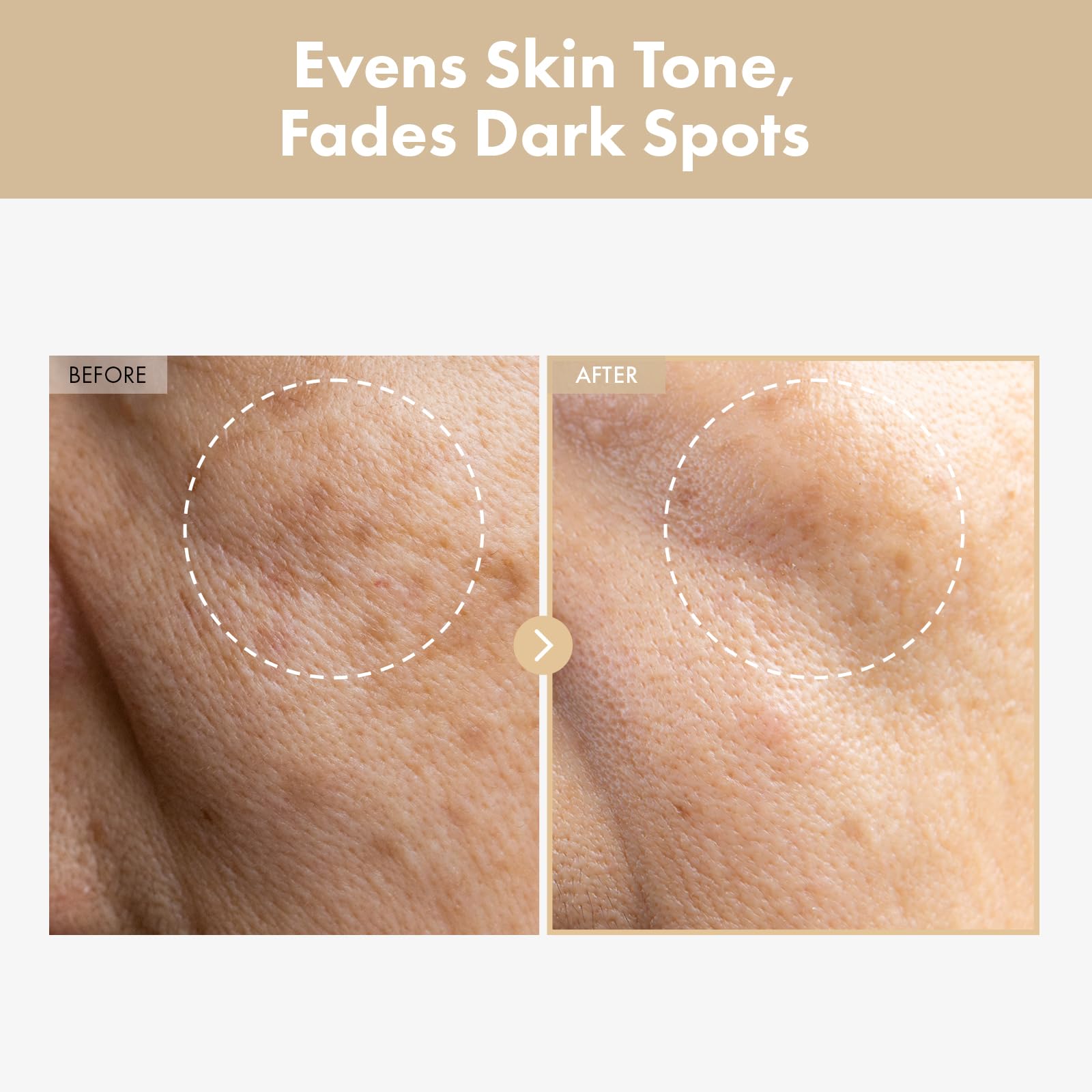 TOSOWOONG Rice Glow Toner, application fluide, laisse la peau lumineuse et purifiée.