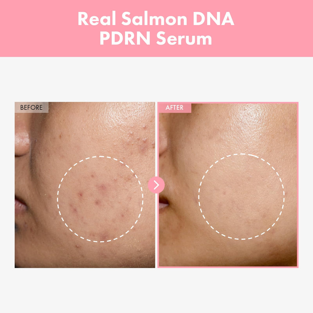 Rituel quotidien avec TOSOWOONG Rose, pour peau radieuse et hydratée.