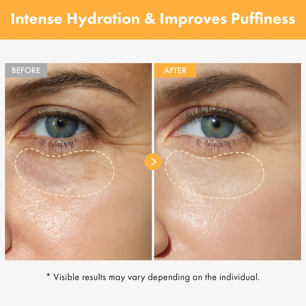 TOSOWOONG Vita Clinic hyaluronique apporte une hydratation durable autour des yeux.