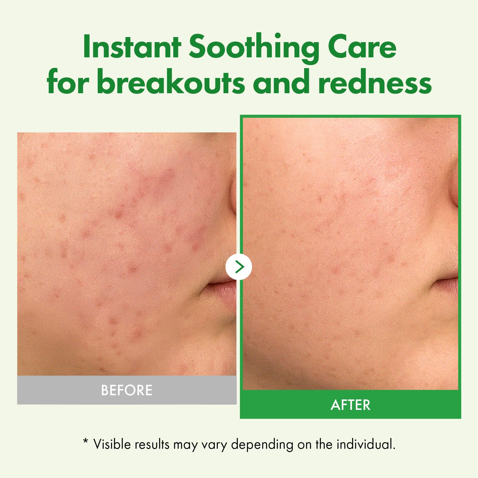 Crème hydratante profonde pour peau sensible et sèche.