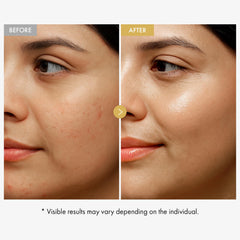 TOSOWOONG Glow Bean Hydratation Prolongée pour peau souple et éclat.