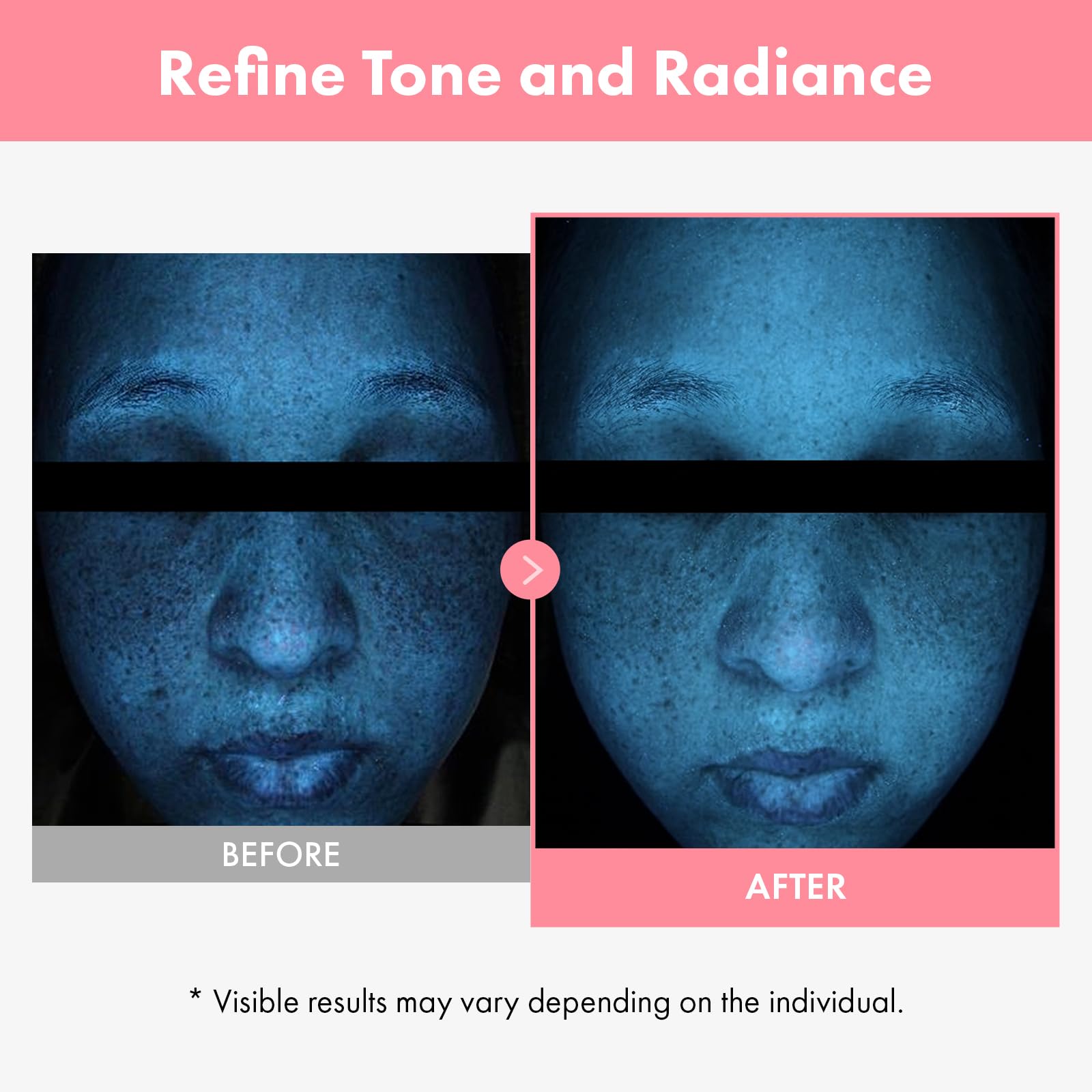 Ingrédients PDRN et Hyaluronique, amélioration de la texture de la peau.