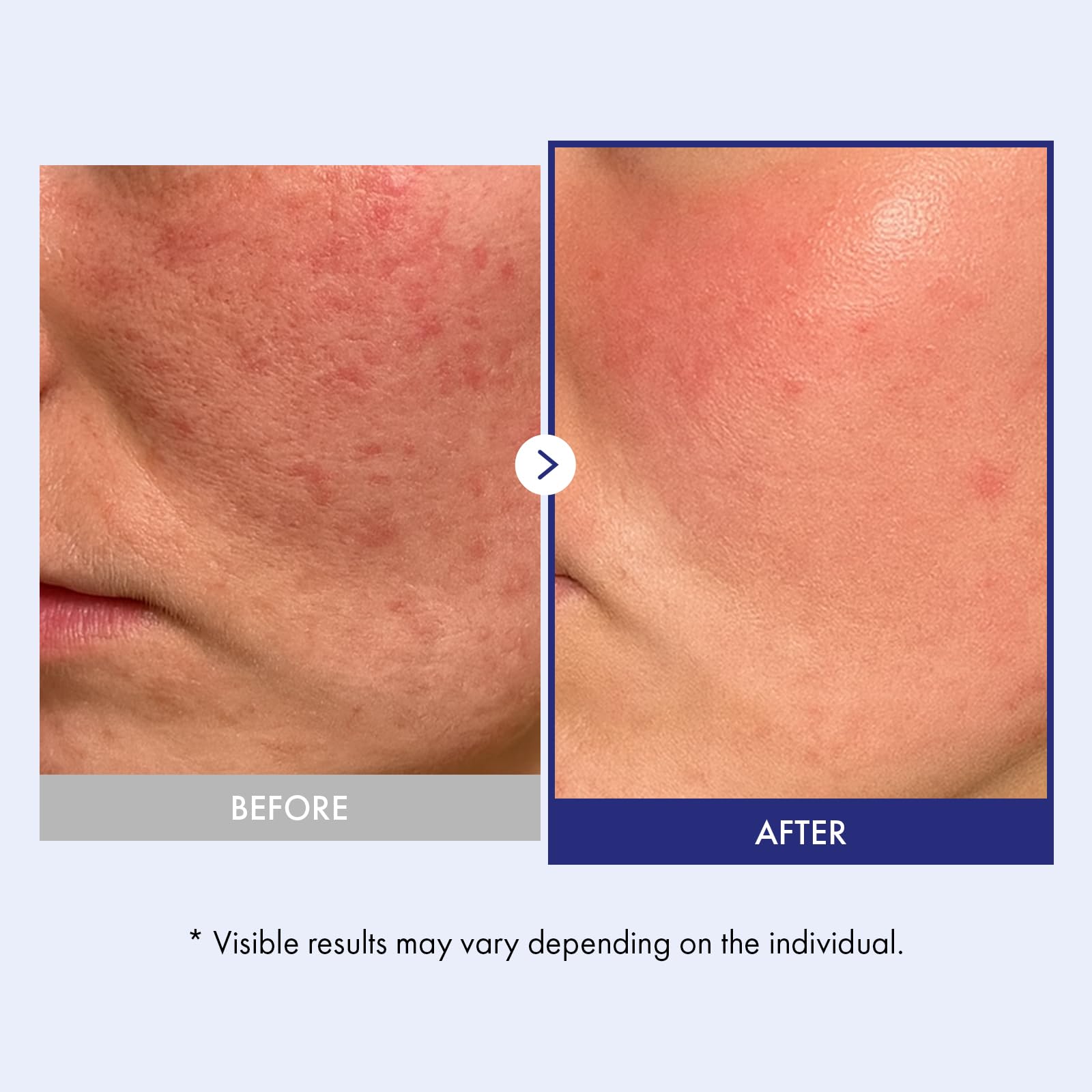 Application visage avec Panthenol 20 Barrière Crème et hydratation durable.