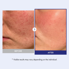 Application visage avec Panthenol 20 Barrière Crème et hydratation durable.