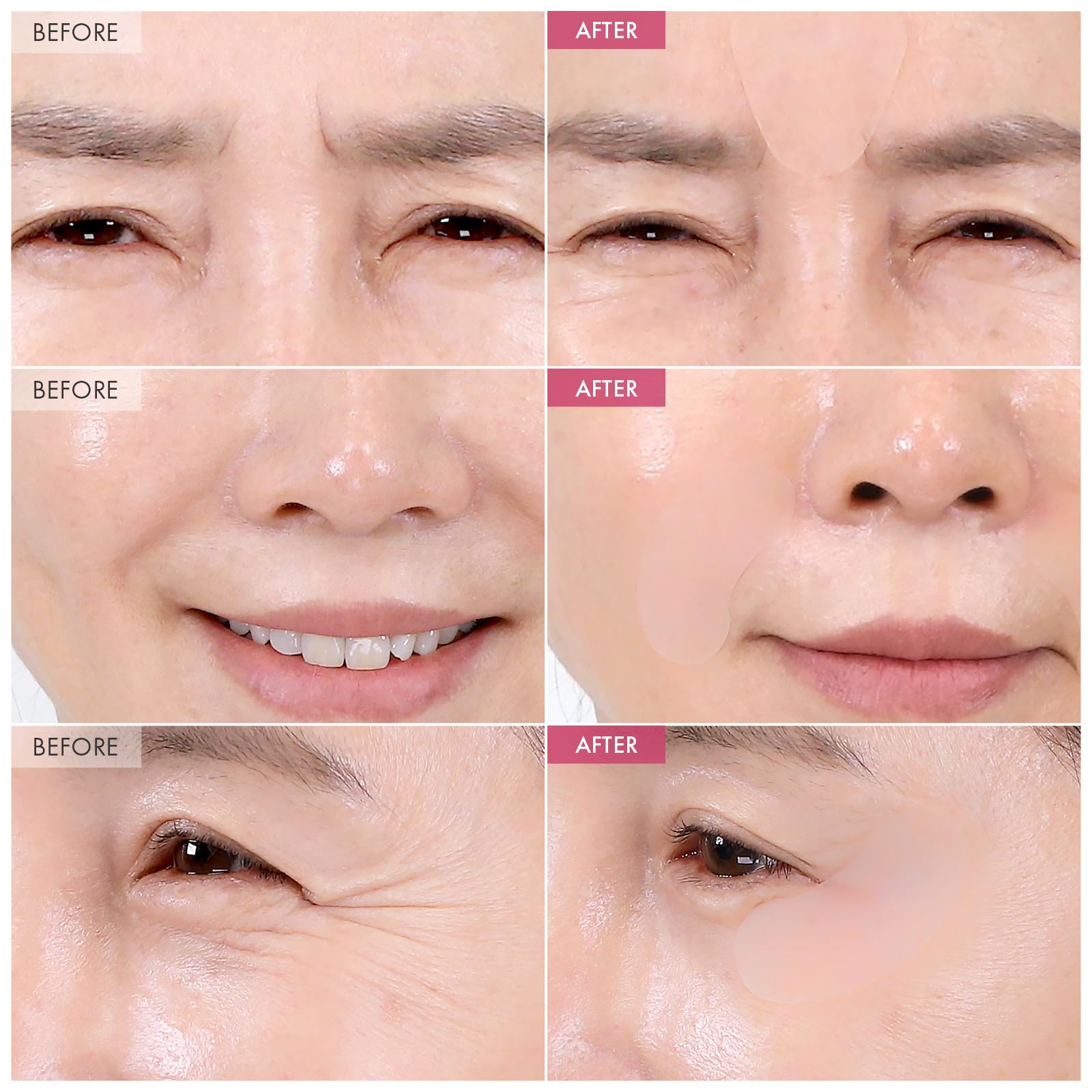 Patchs yeux TOSOWOONG ciblant les ridules autour des yeux pour un regard frais.