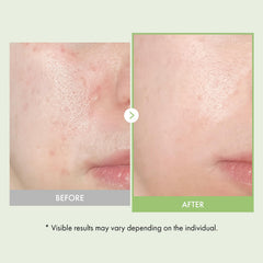 Real Relief Noni Ampoule – Application rapide et absorption légère pour la peau