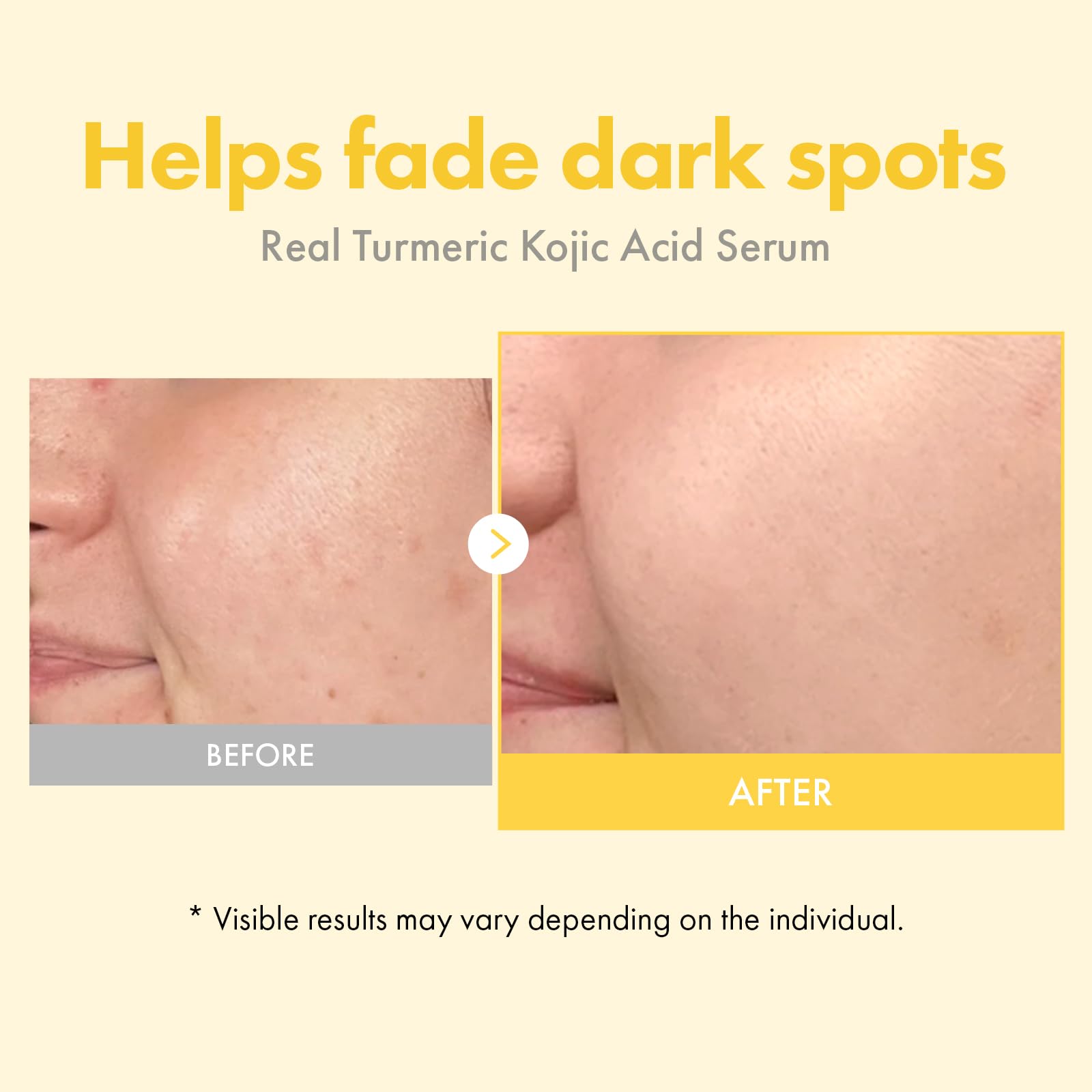 TOSOWOONG Real Turmeric Serum: alpha-arbutine pour le teint homogène.