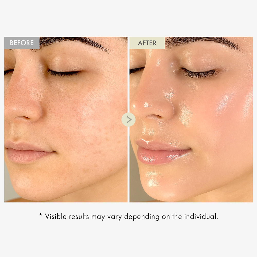 Sérum TOSOWOONG Real Collagen Visage, absorption rapide, peau mieux hydratée et lisse.