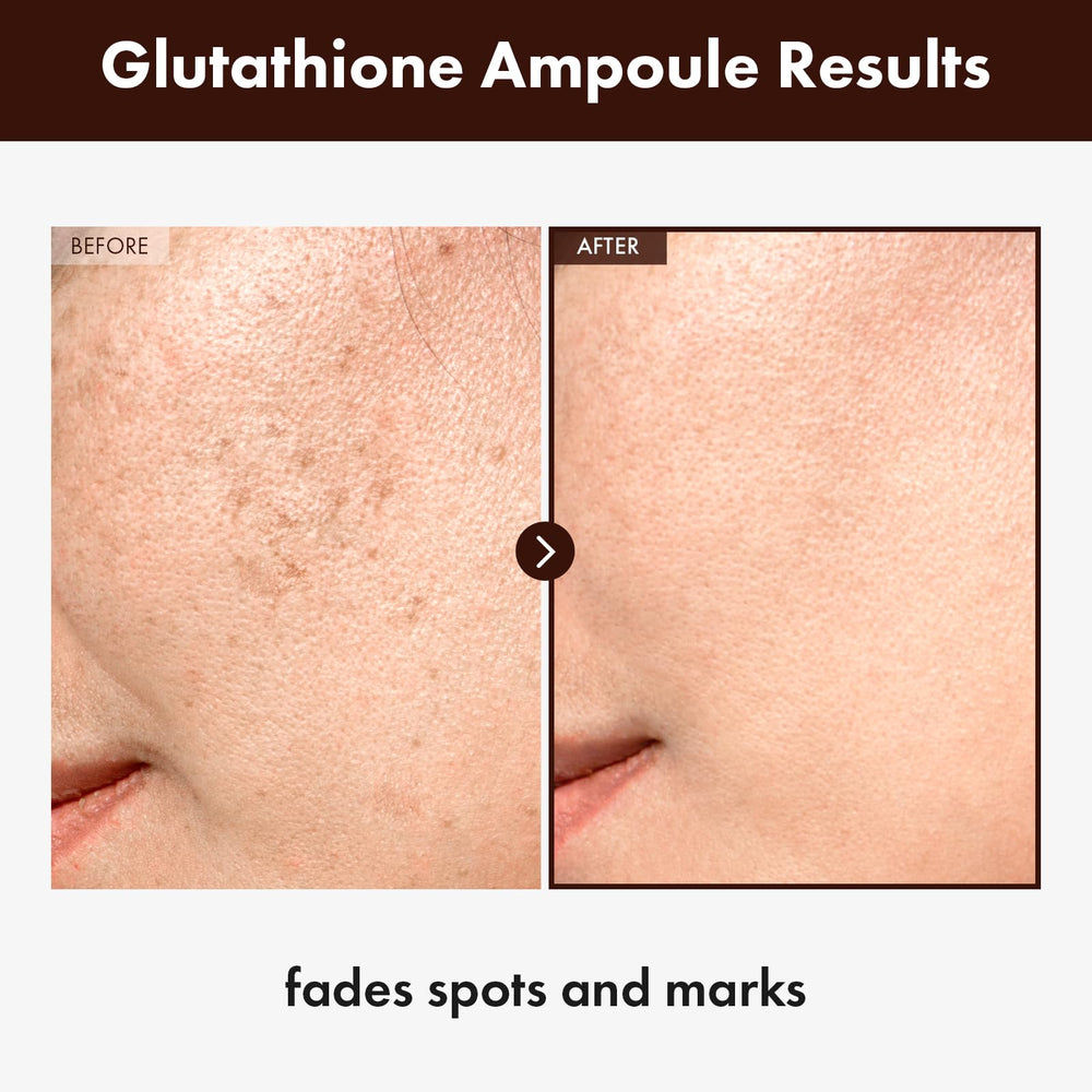 Goutteur précis du sérum glutathion 20000ppm pour une application maîtrisée.