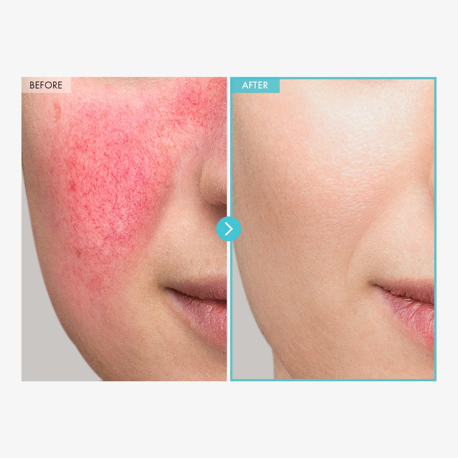 TOSOWOONG SOS Repair cream closeup texture highlights non-nano zinc oxide benefits