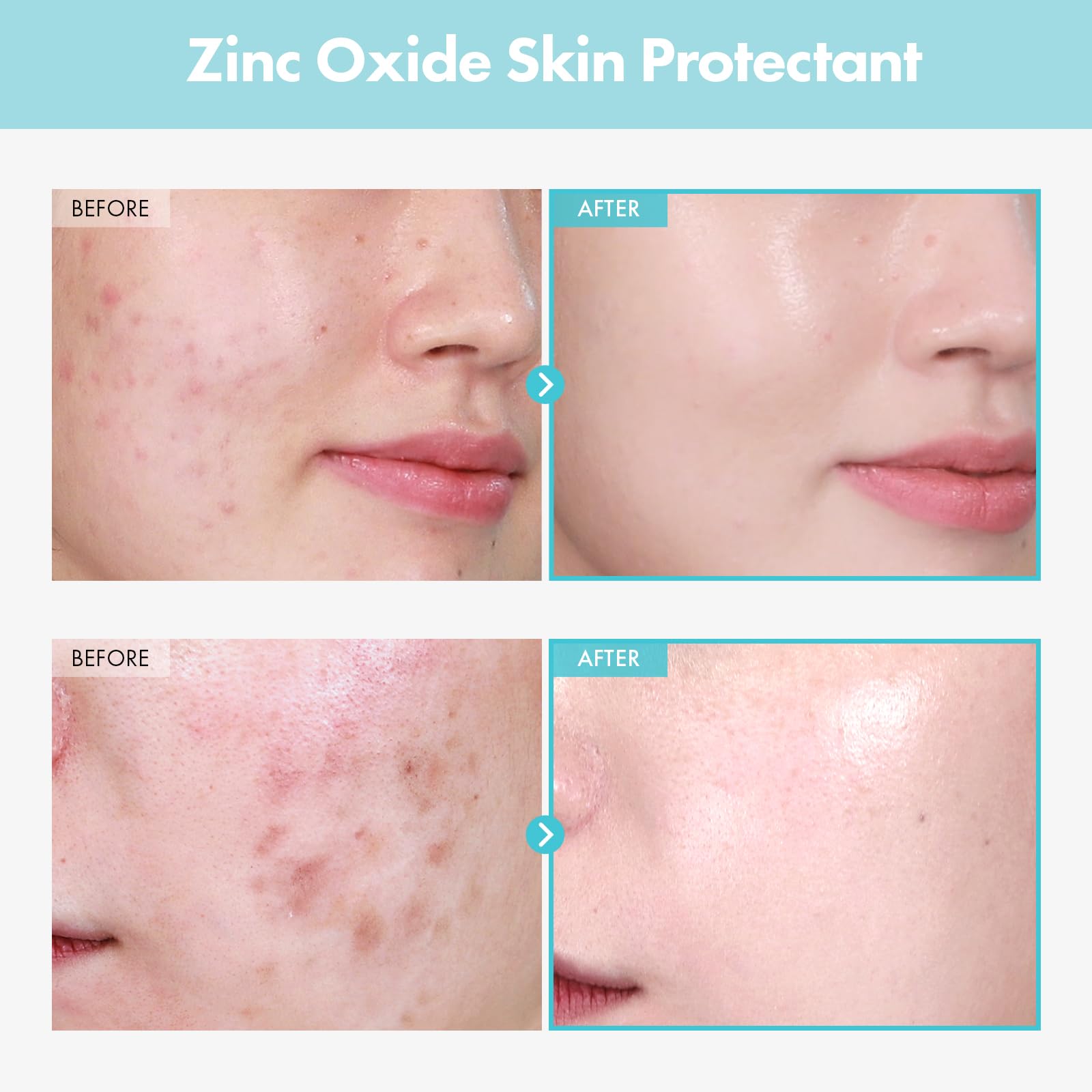 TOSOWOONG SOS Repair CICA swirl on skin demonstrates soothing application