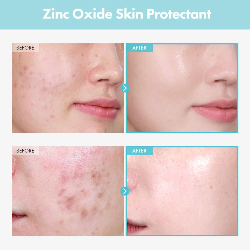 TOSOWOONG SOS Repair CICA swirl on skin demonstrates soothing application