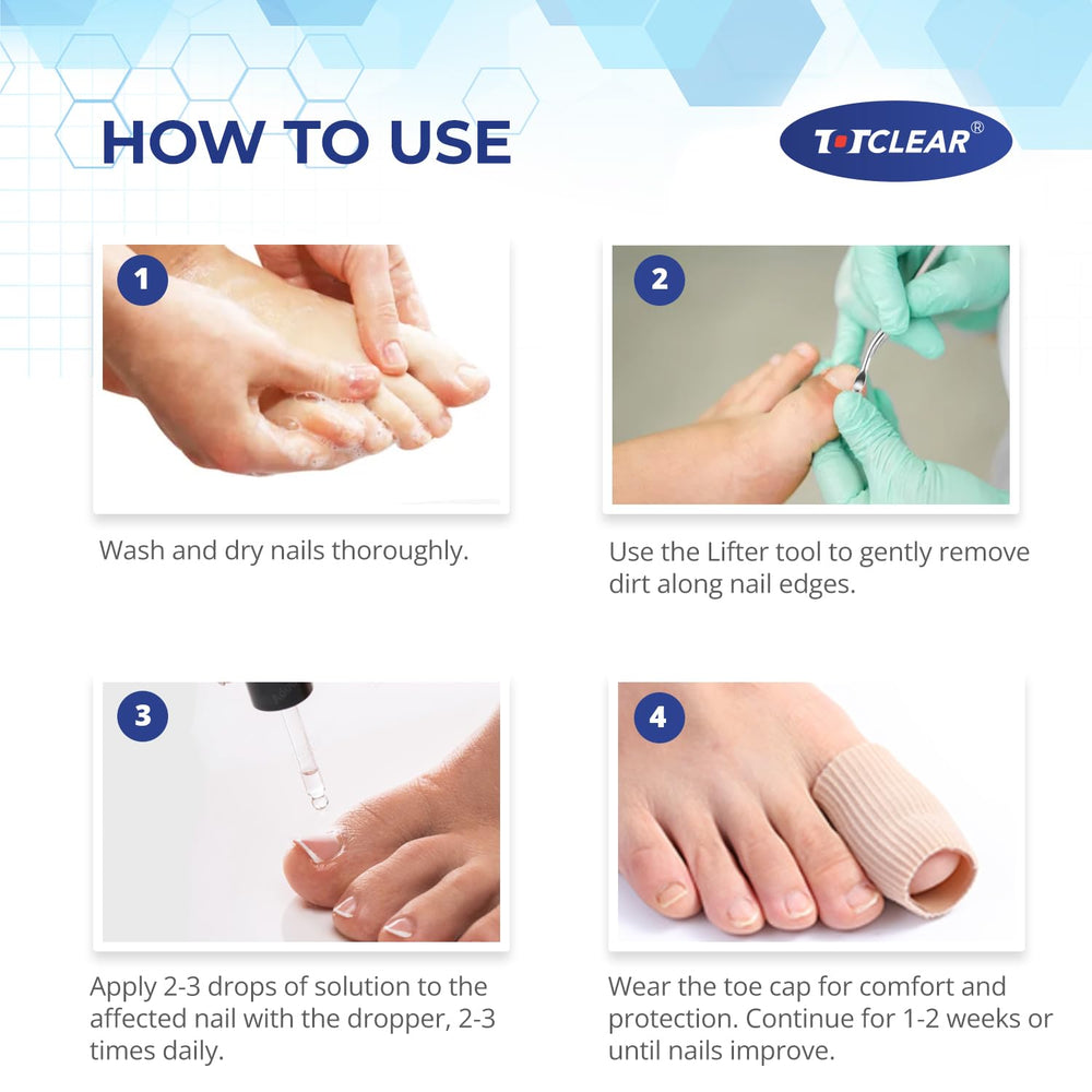 Totclear application-simple-ongle-incarne : utilisation rapide sans dégât.