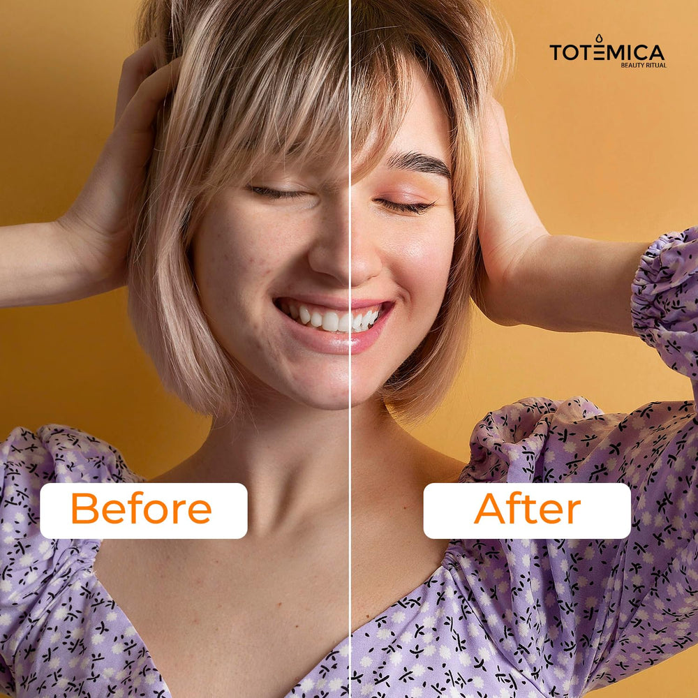 TOTEMICA Sérum vitamine C, usage quotidien pour une peau lumineuse et rafraîchie.