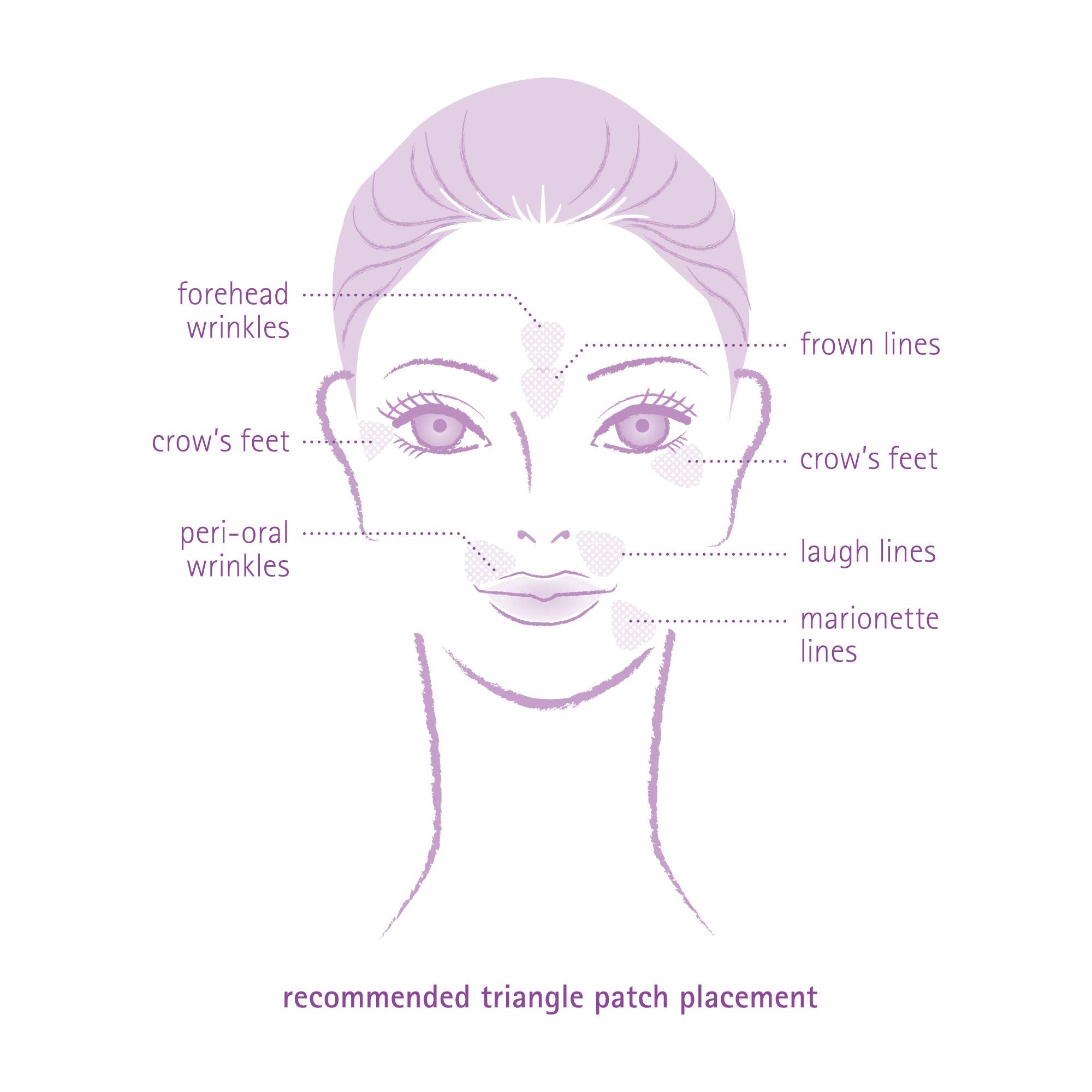 Toute Nuit triangle pansement-visage-lignes-du-sourire: ridules autour du sourire adoucies.