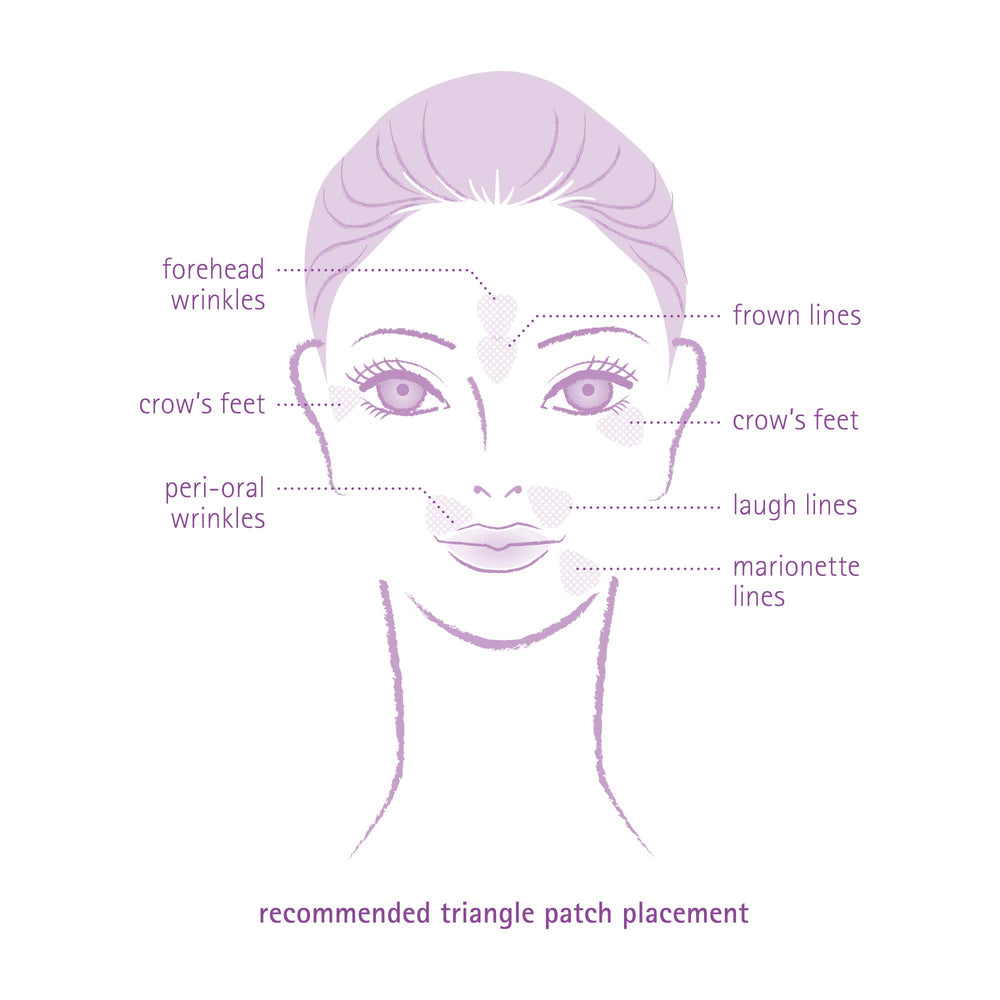Toute Nuit triangle pansement-visage-lignes-du-sourire: ridules autour du sourire adoucies.