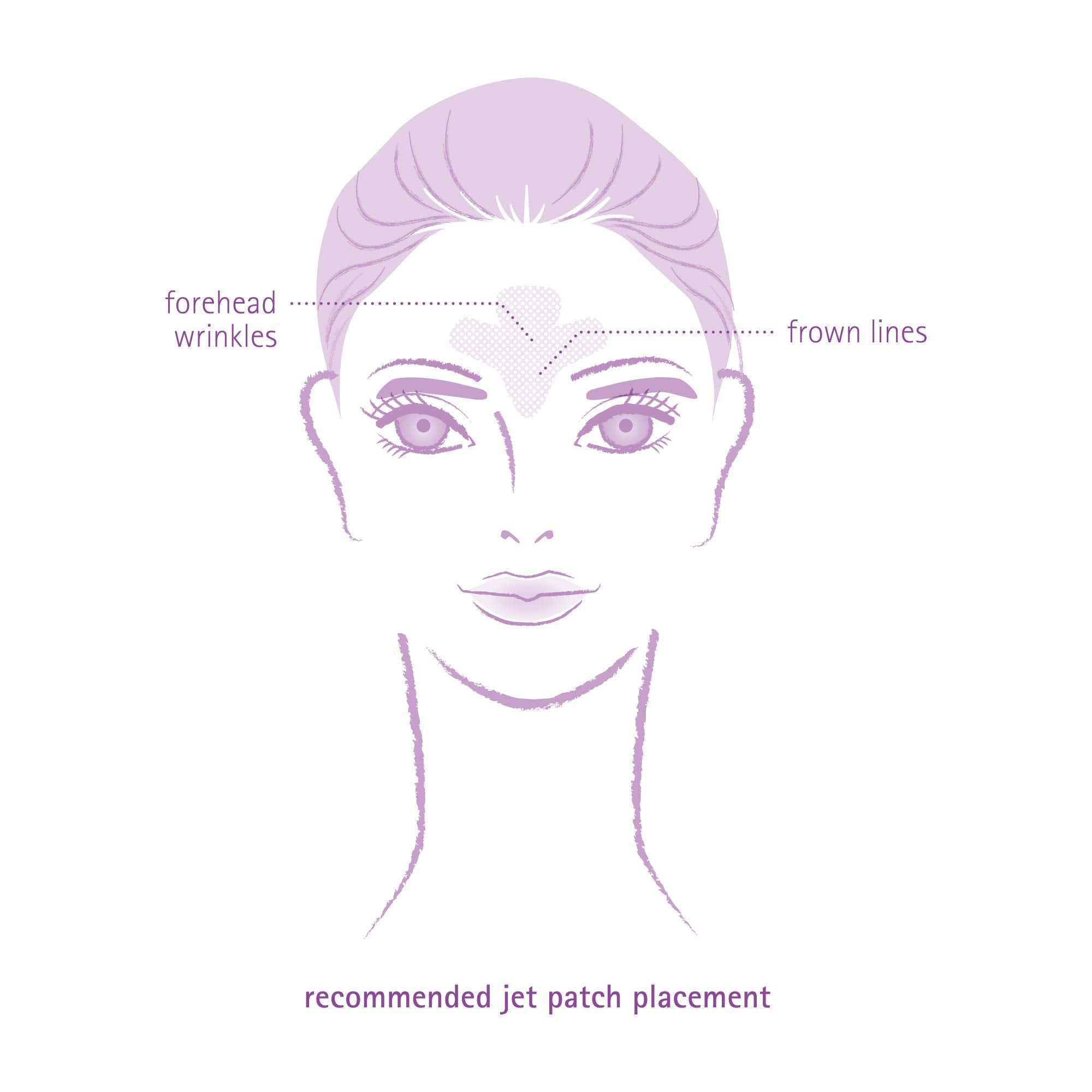 Patch Toute Nuit Peaux Sensibles Sans Parfum, douceur hypoallergénique