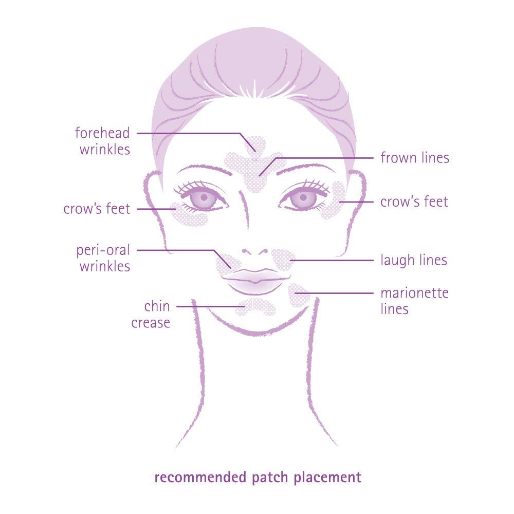 Patch Y-shapes Toute Nuit, couverture ciblée des zones critiques