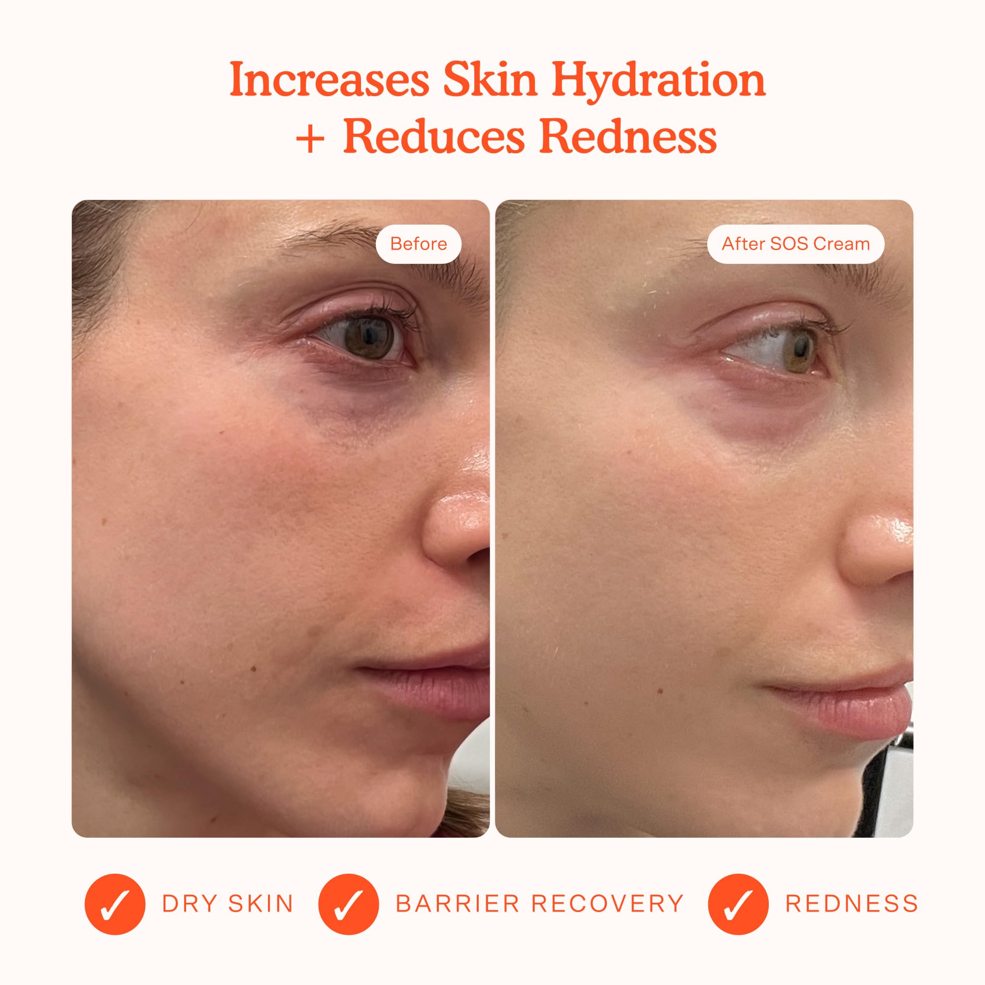 Tower 28 SOS Recovery Crème avec acide hyaluronique pour hydratation en profondeur